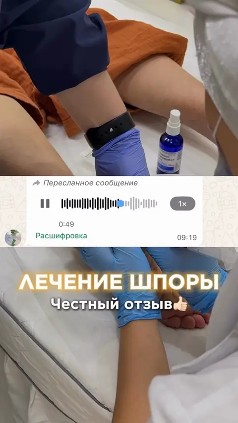 Процедура при пяточной шпоре в клинике Reflex